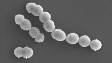 A群溶血性連鎖球菌