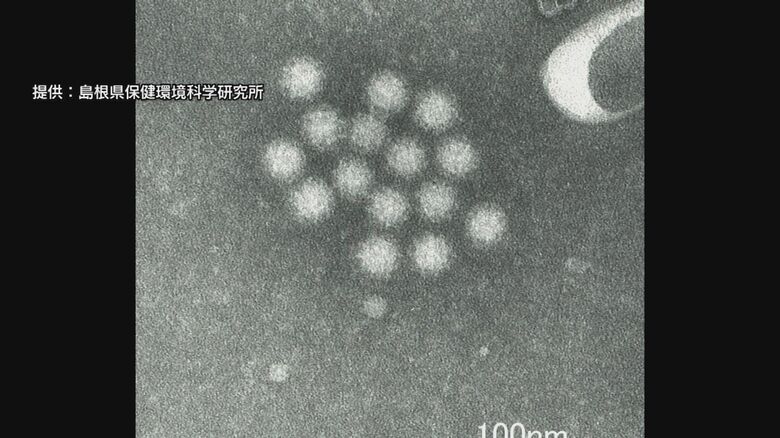 ノロウイルス（電子顕微鏡画像）