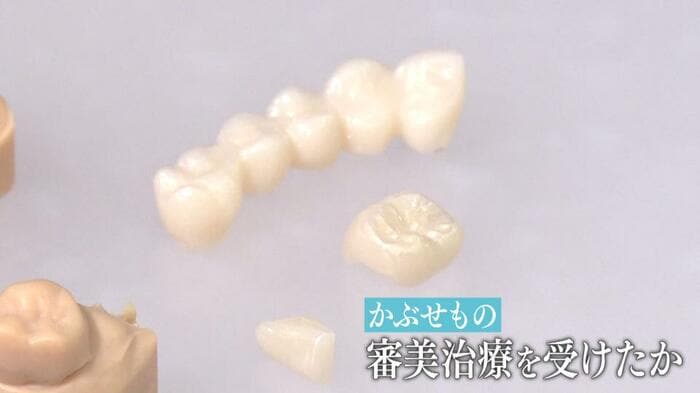 水原被告は審美治療を受けたのか…