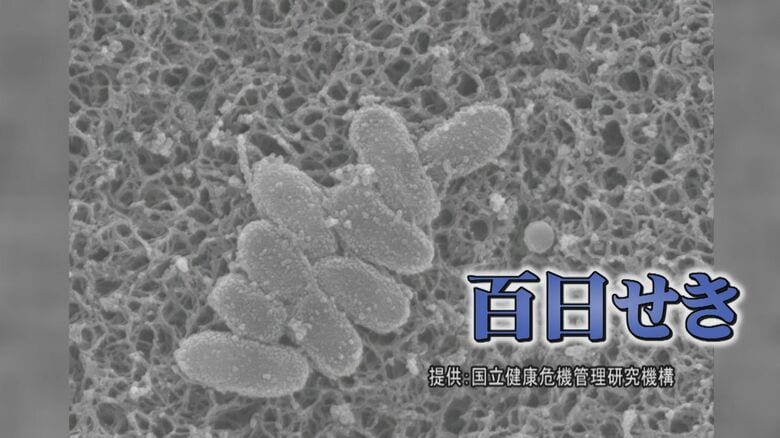 「生後2か月までの赤ちゃんは特に注意！」百日咳が全国的に感染拡大…感染症のエキスパートが語る対策【島根発】｜FNNプライムオンライン