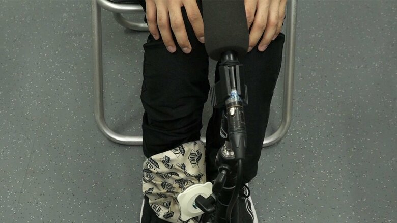 演技後、足を冷やしていた垣内（近畿選手権）