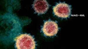 新型コロナ 東京都で19人感染確認 2020年6月17日以来20人以下に