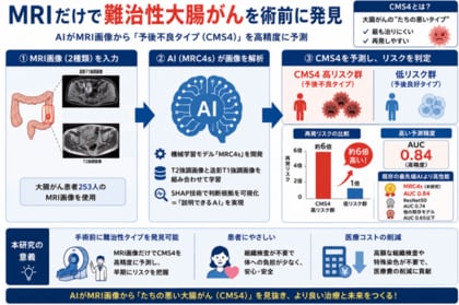 MRI画像だけで大腸がんの「予後不良タイプ」を見抜く！―体や医療コストの負担が少ない術前診断 AIを開発―