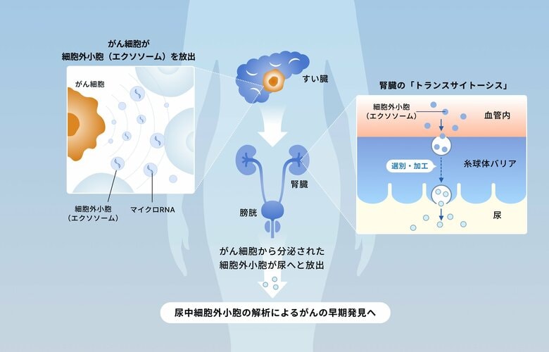 がんのサインは、血液よりも「尿」へ。その仕組みを世界で初めて解明