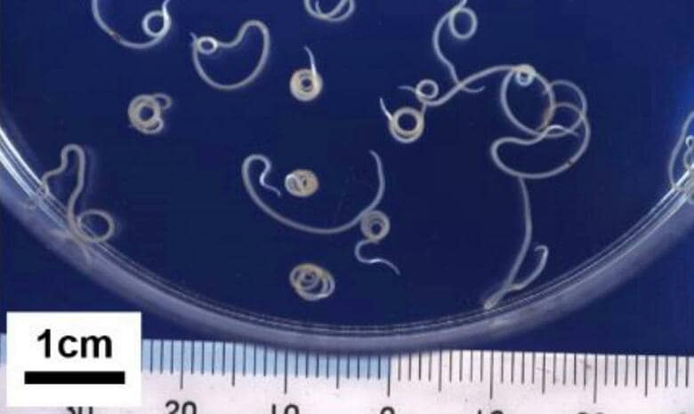 石巻市の人気寿司店でアニサキスによる食中毒　４０代男性が腹痛や嘔吐などの症状　営業一部停止に〈宮城〉｜FNNプライムオンライン