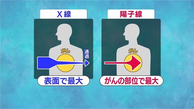 X線と陽子線の違い