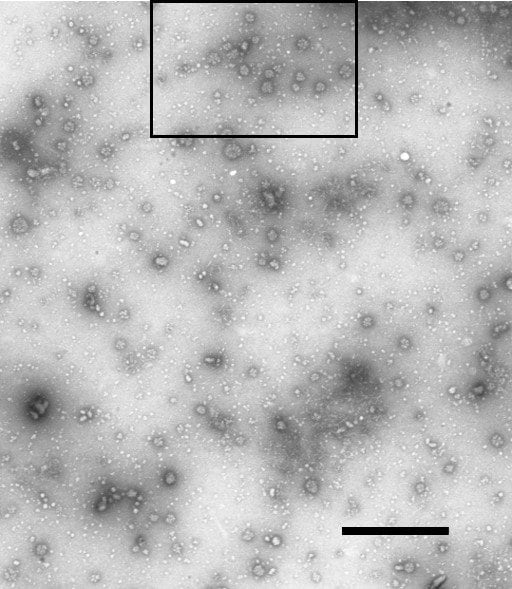 電子顕微鏡で確認された“塊”（提供：島根大学 秋広高志助教）