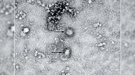 新型コロナ 東京都で新たに28人の感染確認