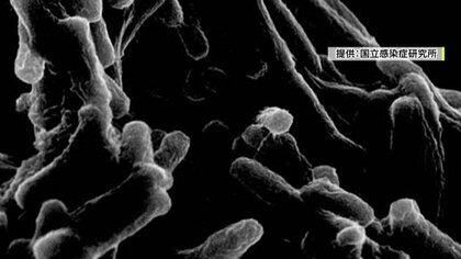 昔の病気ではない！？　34人…結核の集団感染　現代では“薬を飲めば治る病気”　2週間以上せきが続く場合は受診を
