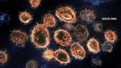 全国で新たに1943人感染 55人死亡 東京467人感染 前週より増加