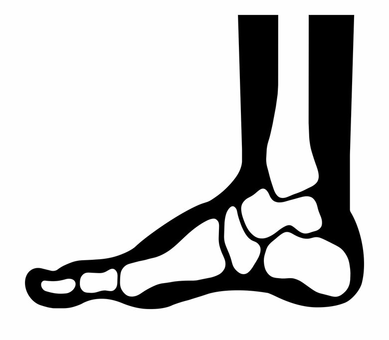 足の骨は本来アーチ状の橋のような形（画像はイメージ）