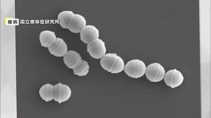 「溶連菌」の感染が止まらない…患者が過去10年で最多　大人も要注意！手足の壊死・多臓器不全　死に至るケースも