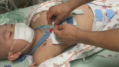 闘病中の子どもたちを明るくさせる　かわいい“医療グッズ”　きっかけは息子の小児白血病　身に着けることで話すきっかけに