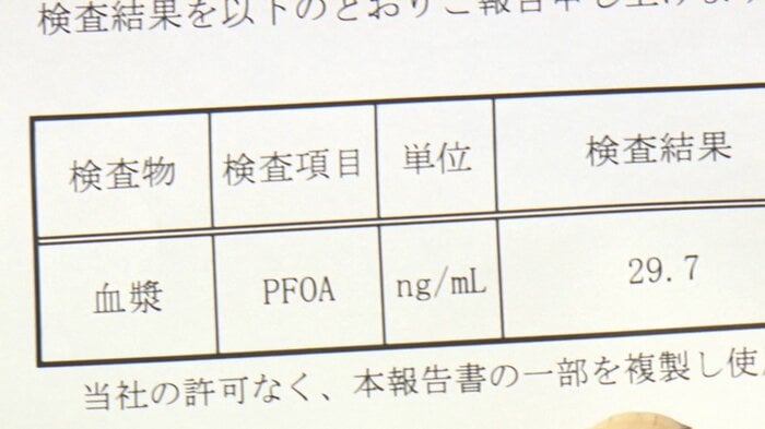 鈴木さんの検査結果