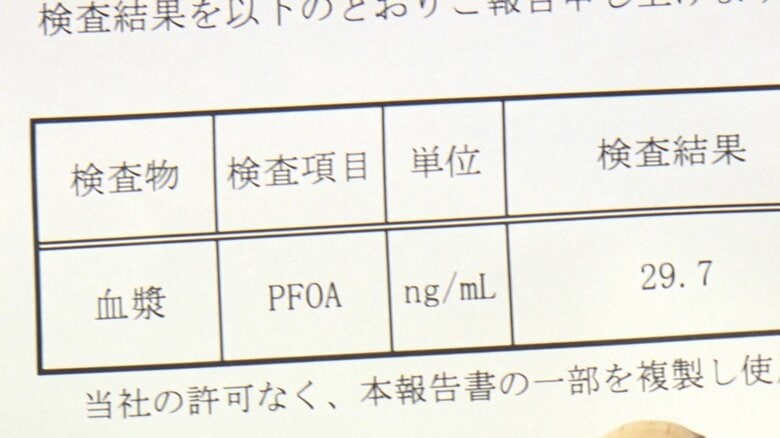 鈴木さんの検査結果
