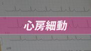 小さなサインが大きなリスクに…放置しないで「不整脈」　心房が無秩序に震える「心房細動」は血流がよどみ脳梗塞の原因にも