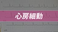 小さなサインが大きなリスクに…放置しないで「不整脈」 心房が無秩序に震える「心房細動」は血流がよどみ脳梗塞の原因にも