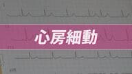 小さなサインが大きなリスクに…放置しないで「不整脈」　心房が無秩序に震える「心房細動」は血流がよどみ脳梗塞の原因にも