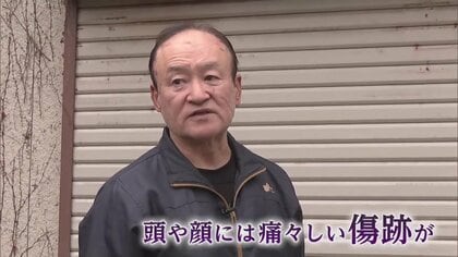 「俺は死ぬんだなと思った」クマに襲われた被害者のリアルな証言　“人身被害”過去最悪の70人【秋田発】