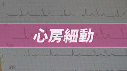 小さなサインが大きなリスクに…放置しないで「不整脈」　心房が無秩序に震える「心房細動」は血流がよどみ脳梗塞の原因にも