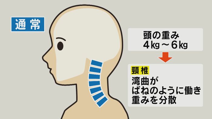 通常は頸椎の湾曲がバネのような働きをする