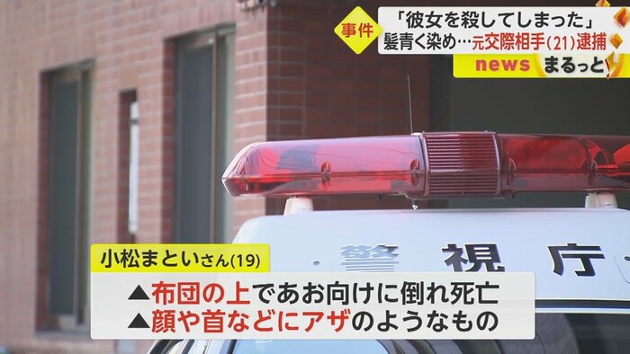 小松さんの顔や首には、あざのようなものが残されていた
