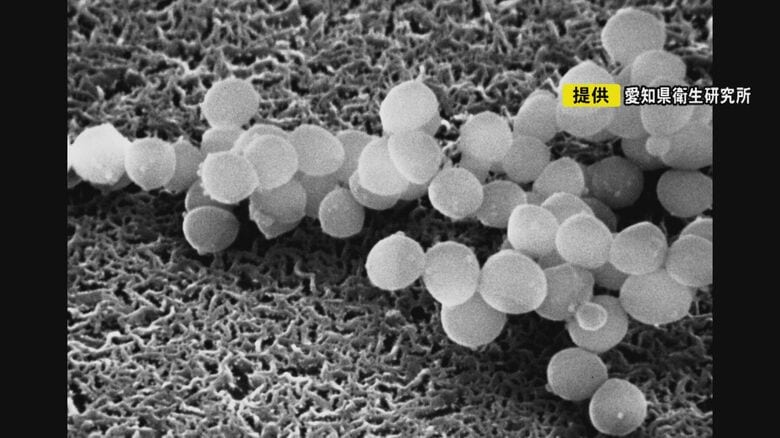 黄色ブドウ球菌など…急な暑さで“細菌性の食中毒”に注意 仕出し弁当つくる店では「3月後半から保冷剤」｜FNNプライムオンライン
