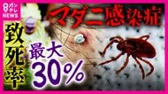 “致死率最大30％”『マダニ感染症』急増　奈良のシカや遊具ある公園にもマダニの姿が…　「里山消失」で人住む場所に出没