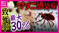 “致死率最大30％”『マダニ感染症』急増　奈良のシカや遊具ある公園にもマダニの姿が…　「里山消失」で人住む場所に出没