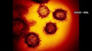 新型コロナ 東京都で新たに1240人の感染確認 重症者は過去最多の155人【1月19日】