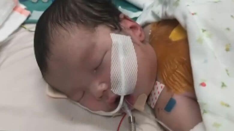 “心臓ポンプ”が働かない難病と闘う2歳児　命を支え、付き添い家族の笑顔を守るファミリーハウスが存続の危機に｜FNNプライムオンライン