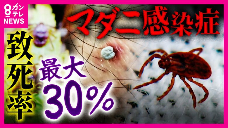 “致死率最大30％”『マダニ感染症』急増　奈良のシカや遊具ある公園にもマダニの姿が…　「里山消失」で人住む場所に出没｜FNNプライムオンライン