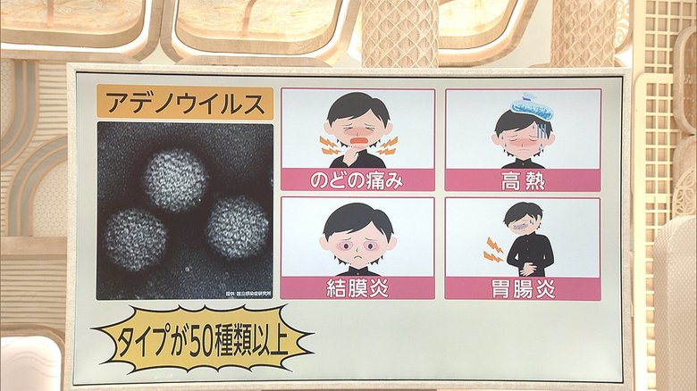 3分でわかるキーワード 海老蔵さんも...アデノウイルス