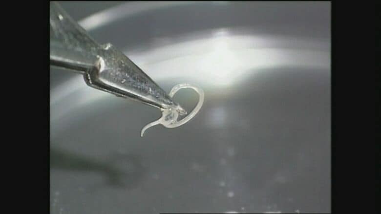 資料　アニサキス寄生虫