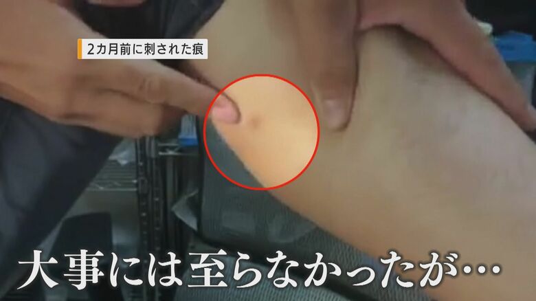 男性が刺された跡