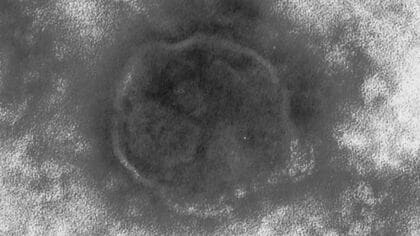 はしかに感染の女性が「特急しなの」塩尻駅ー名古屋駅を利用　全国の感染者数は去年同時期の10倍以上　“非常に感染力が強い”　長野県が注意呼びかけ