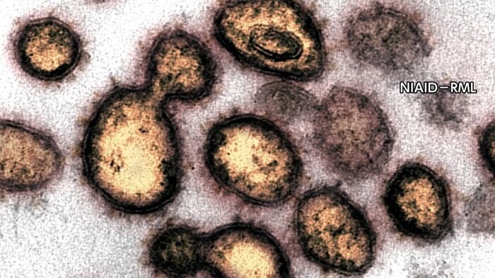 新型コロナ 東京都で新たに220人の感染確認