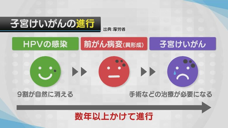 子宮けいがんの進行