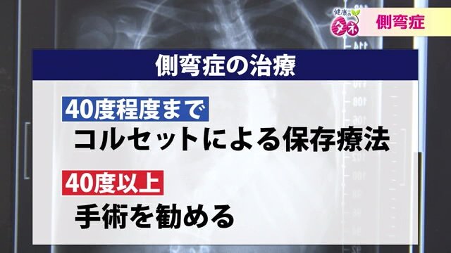 側弯症の治療方法