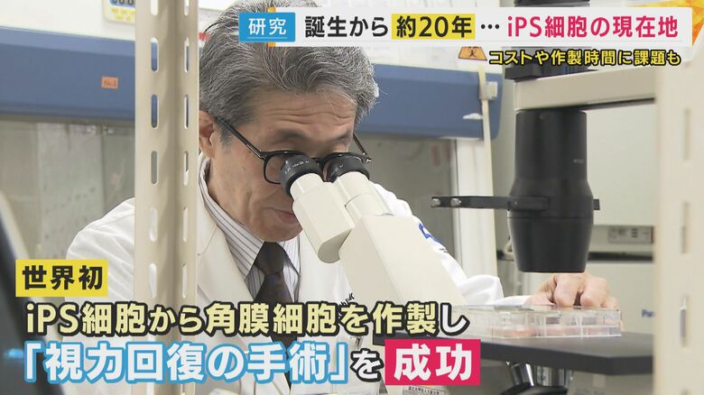 iPS細胞から目全体の細胞を作る