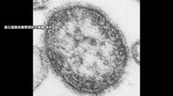 はしか感染者が急増　今年は236人で前年比3.5倍　直近10年で2番目の多さ　国内で二次感染拡大