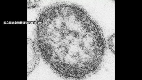 はしか感染者が急増　今年は236人で前年比3.5倍　直近10年で2番目の多さ　国内で二次感染拡大
