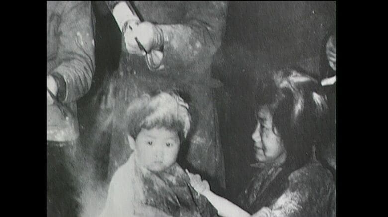 シラミは終戦直後に大量発生