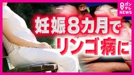 異例の流行「リンゴ病」　潜伏期間長く感染拡大か　妊娠中の感染で流産リスクも　ワクチンはなく感染対策は「手洗い・うがい・マスク」
