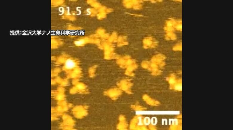 レカネマブが作用する瞬間を捉えた映像