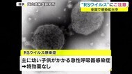 子供は注意!!かぜに似た症状「RSウイルス感染症」が拡大 重症化も 注意点は…【岡山・香川】