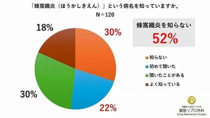 梅雨・夏に注意したい“足の感染症”　むくみを経験する女性の52%が「蜂窩織炎」を知らない