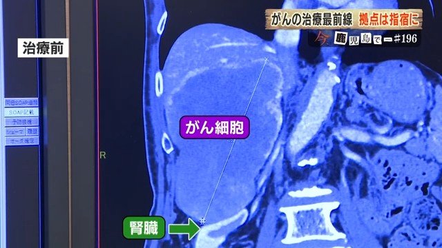 治療前