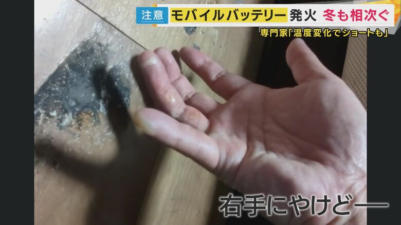 モバイルバッテリーが発火した人