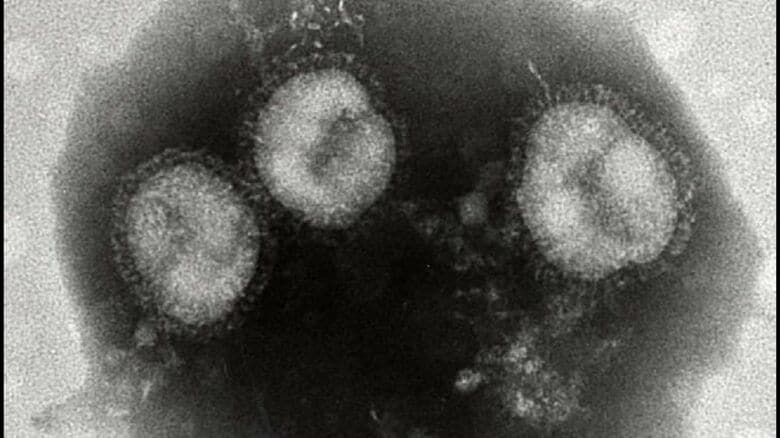 札幌市が「臨時小児ドライブスルー発熱外来」を開設＿12月7日から3月末までの『日祝・年末年始』医師会と連携しインフルエンザや新型コロナの流行に対応＿対象は6歳から15歳の小中学生＜北海道＞｜FNNプライムオンライン